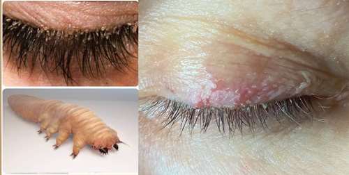 Bonjour, je m'appelle demodex folliculorum et je vis dans les pores de la peau de ton visage c'est pour ça qu'il est important de laver ton visage, te démaquiller et nettoyer tes pinceaux maquillage régulièrement !! Image